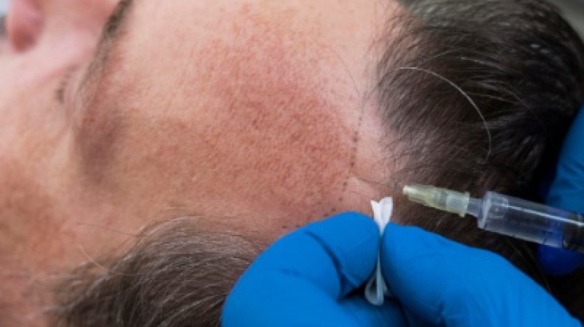 3 Days Istanbul City Tour and Hair Transplant Package photo 5